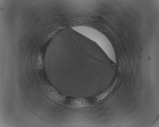 X0000081390420200702020300