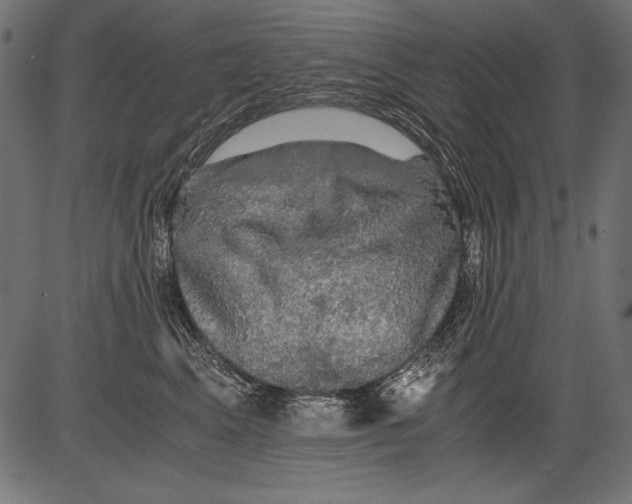 X0000081390617200702020257