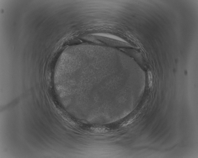 X0000081390693200702020256