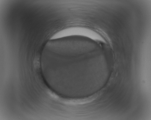 X0000081390017200702090049