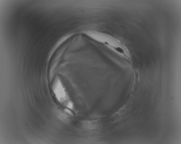 X0000081390147200702090047