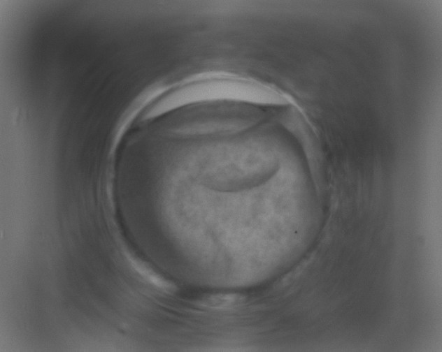 X0000081390152200702090047