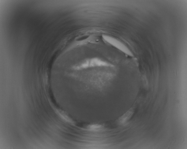 X0000081390158200702090047