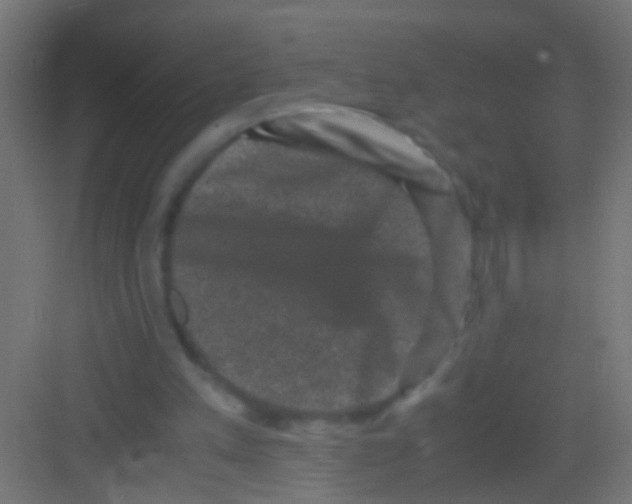 X0000081390197200702090046