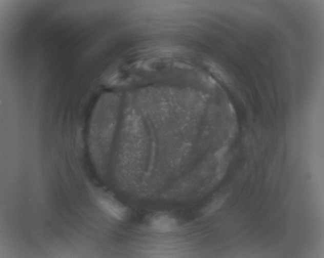 X0000081390258200702090045