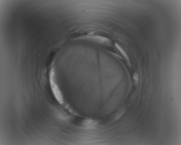 X0000081390319200702090044