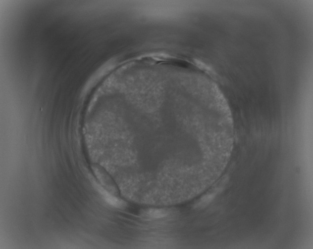 X0000081390341200702090043