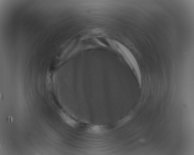 X0000081390382200702090044