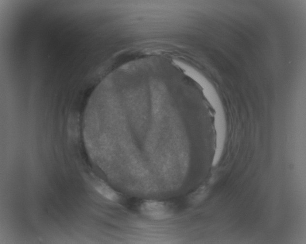 X0000081390413200702090043