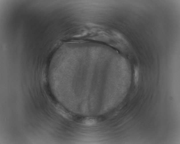 X0000081390604200702090040