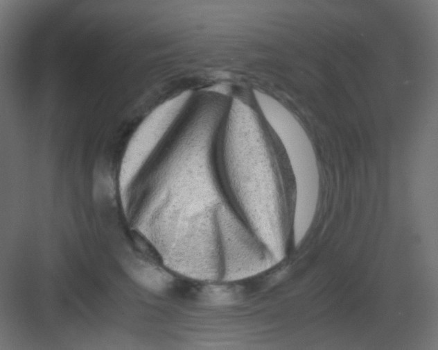 X0000081390613200702090039