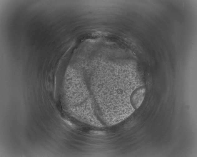 X0000081390649200702090039