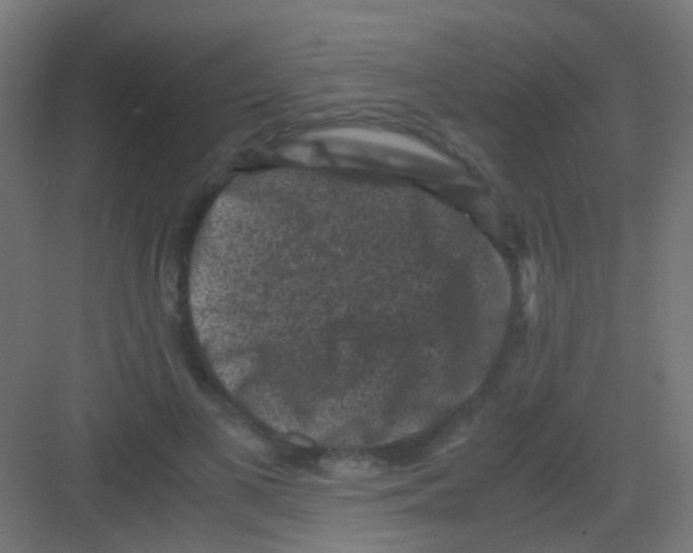 X0000081390693200702090038