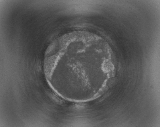 X0000081390758200702090037