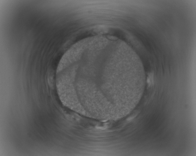 X0000081390867200702090035