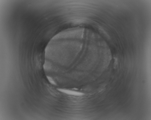 X0000081390868200702090035