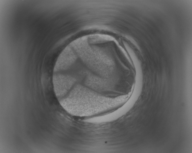 X0000081390872200702090035