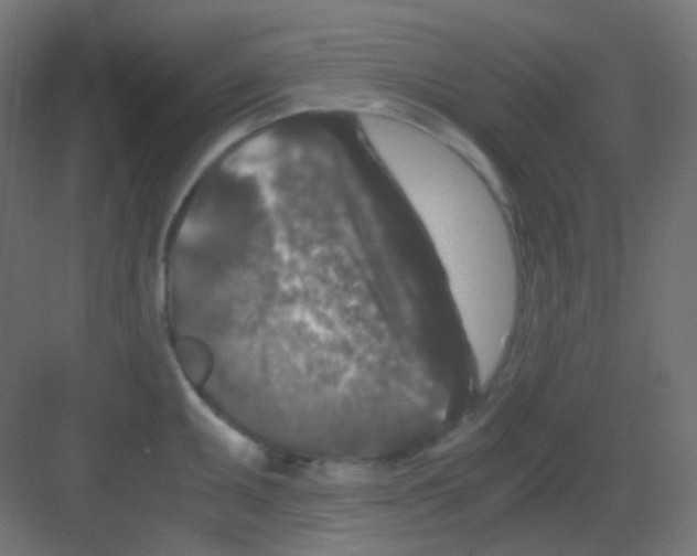 X0000081391095200702090031