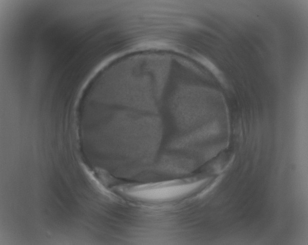 X0000081391118200702090031