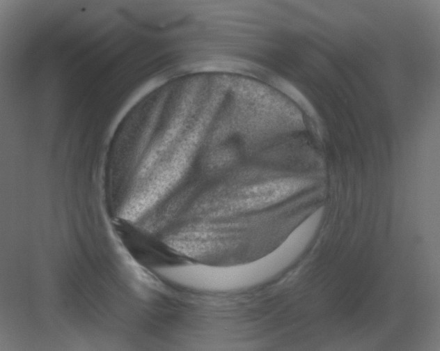 X0000081391138200702090031