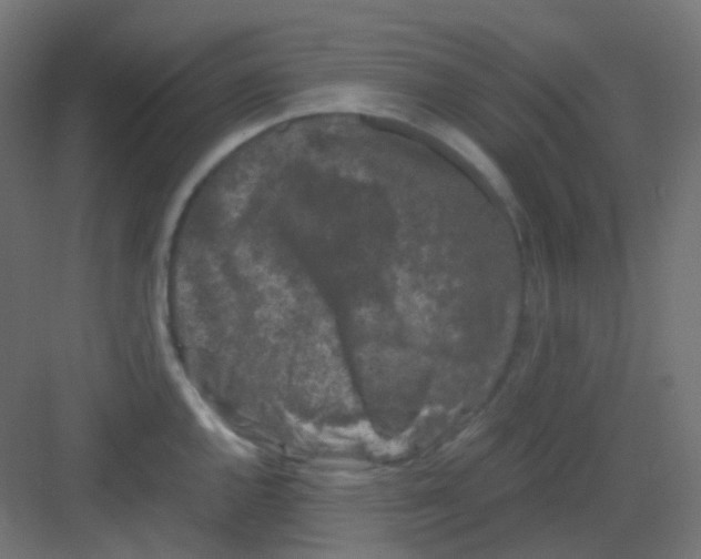 X0000081391144200702090031