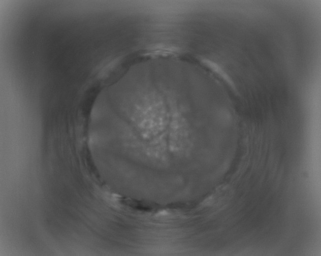 X0000081391399200702090026