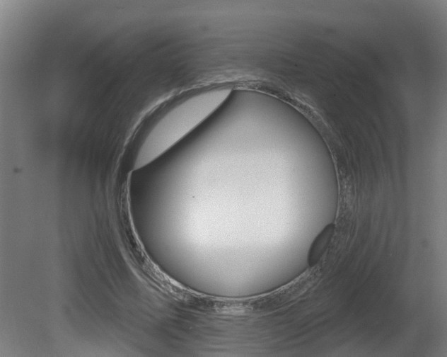 X0000081400587200701111235