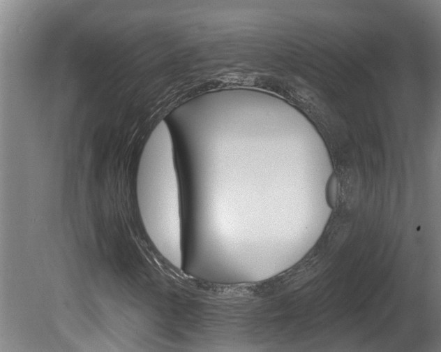 X0000081401154200701111225