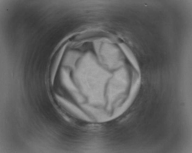 X0000081400052200702090114