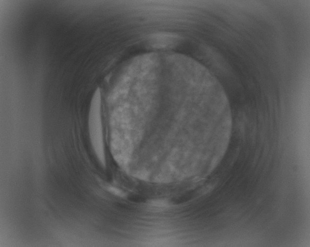 X0000081400076200702090114