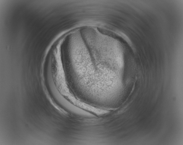 X0000081401128200702090057