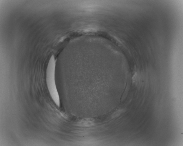 X0000081411156200701261816