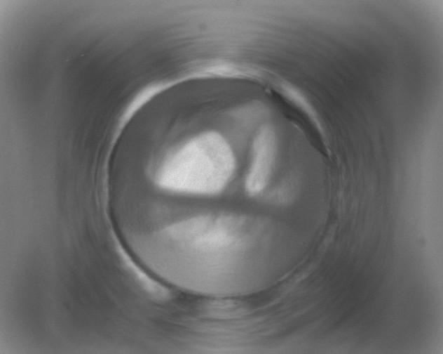 X0000081411479200701261811