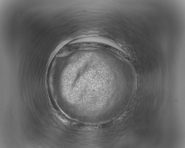 X0000081420147200701191605