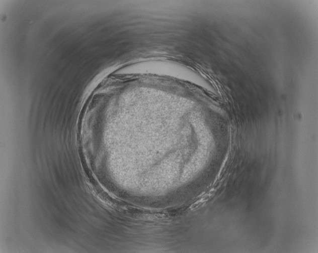 X0000081420147200701261602