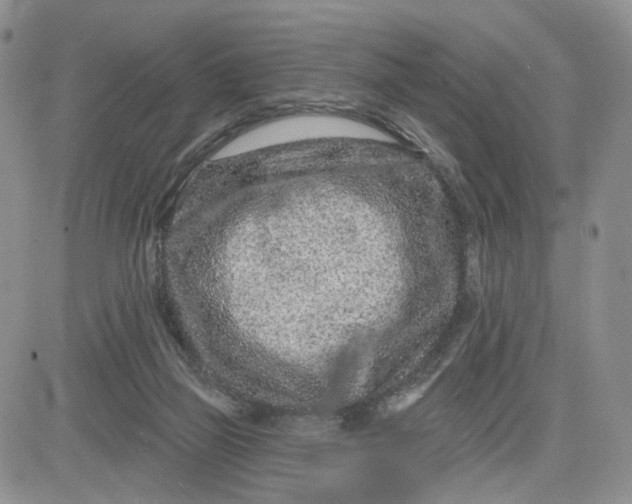 X0000081420165200701261603