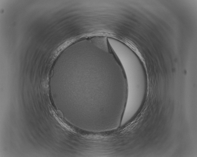 X0000081420389200702021633