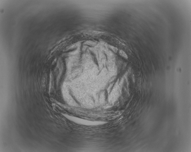 X0000081421397200702021616