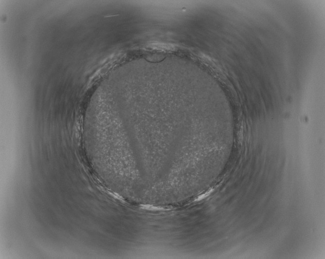 X0000081431397200701261811