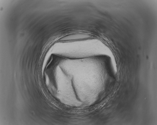 X0000081430049200702021702