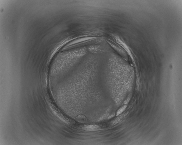 X0000081430059200702021702