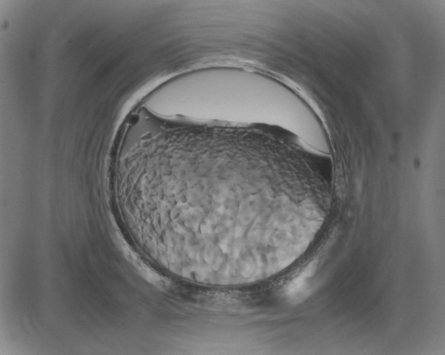 X0000081430995200702021648