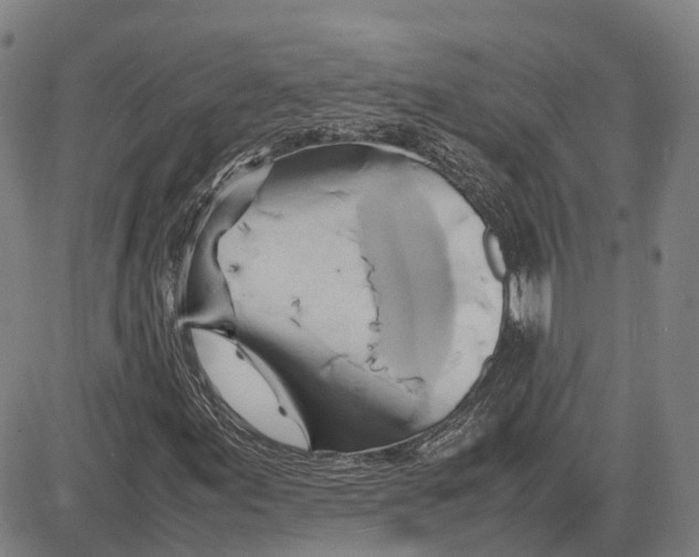 X0000081431155200702021645