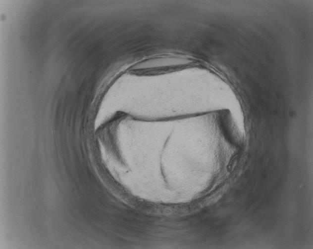 X0000081430049200702092210