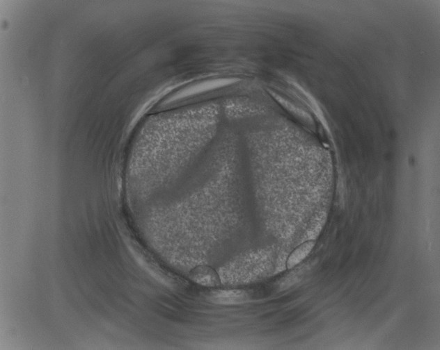 X0000081430059200702092210