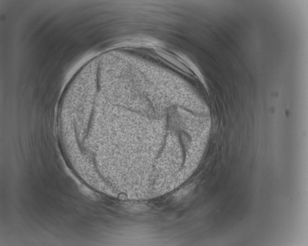 X0000081431103200702092153