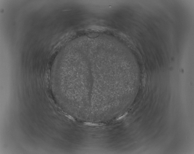 X0000081431397200702092147