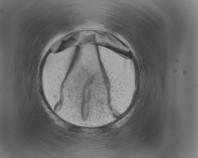 X0000081431469200702092147