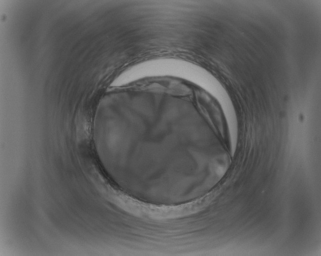 X0000081440039200702021728