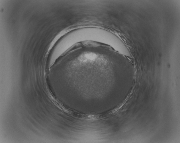 X0000081440056200702021727